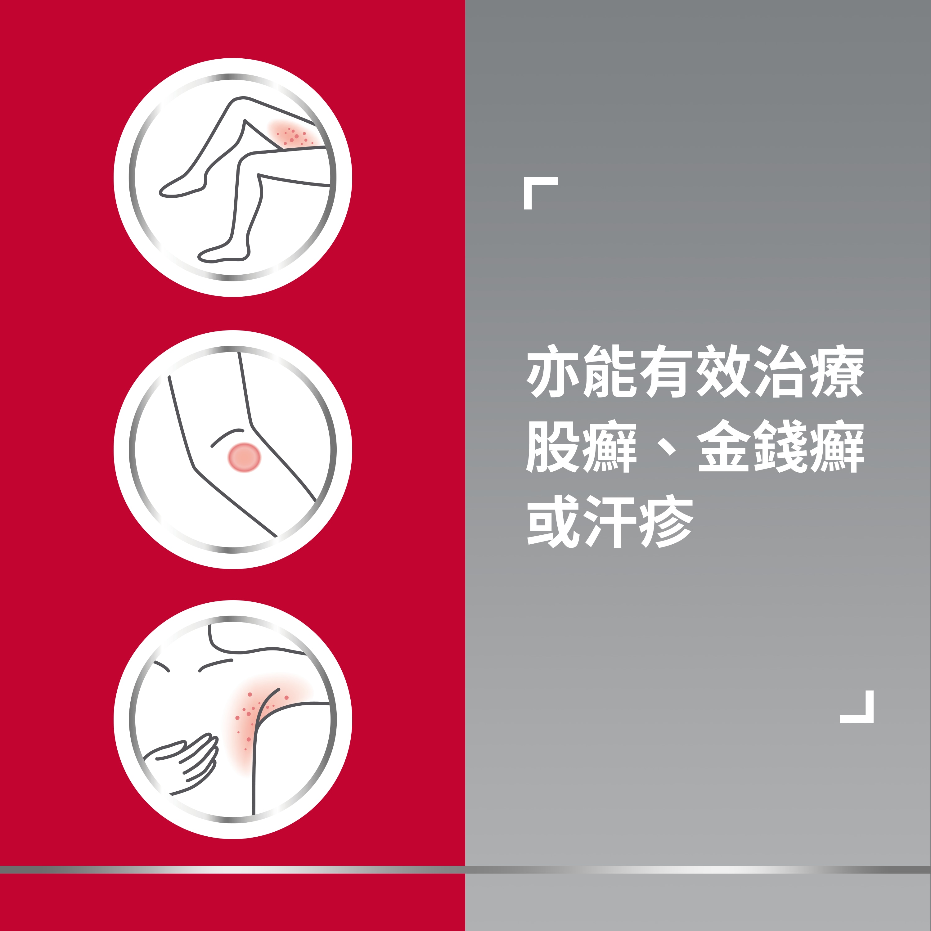 Three icons of itchy patches on inner thigh, elbow, and armpit, with caption on the right: Also effective on jock itch, ringworm or sweat rash 